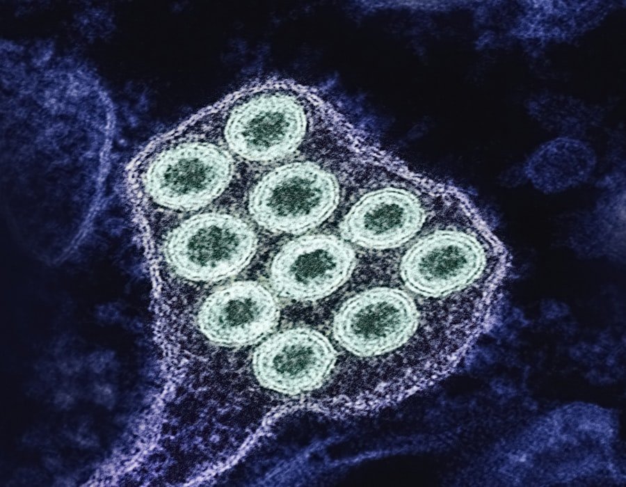 Photo nipah virus