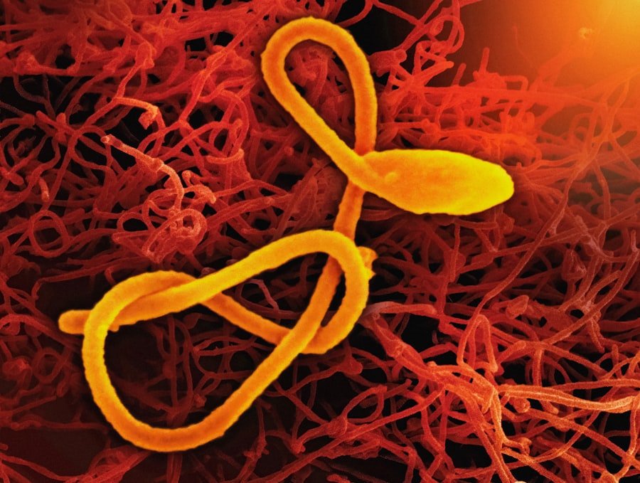 Photo Gut-Immune Connection